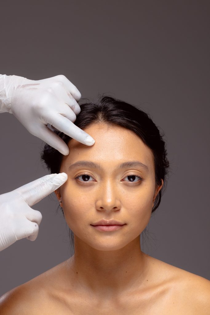 Resultados de Blefaroplastia