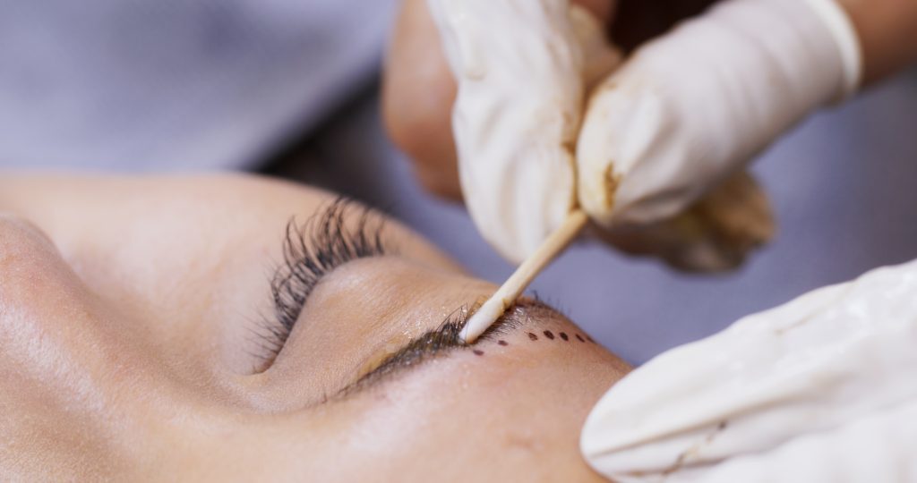 Primer plano Blefaroplastia