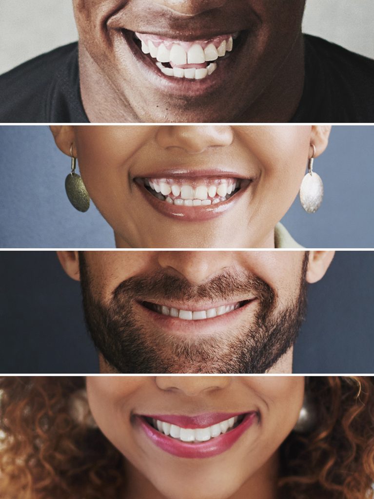 pérdida y desgaste del esmalte dental