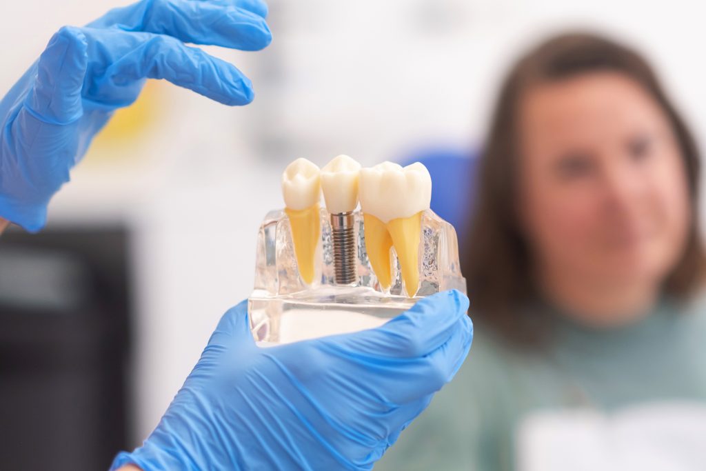 Modelo de implante dental