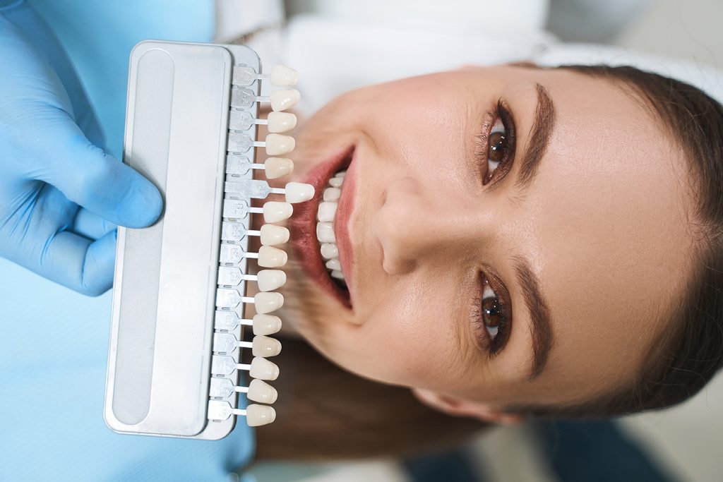 mejorar diseño de sonrisa