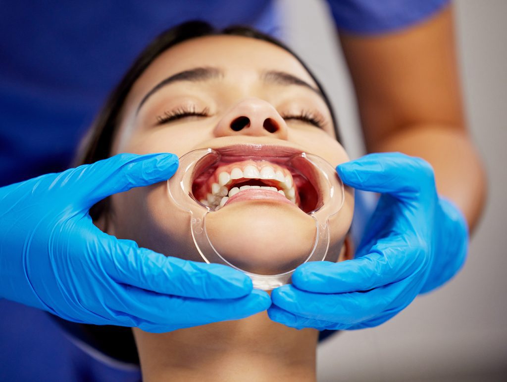evaluación cirugia de mandíbula