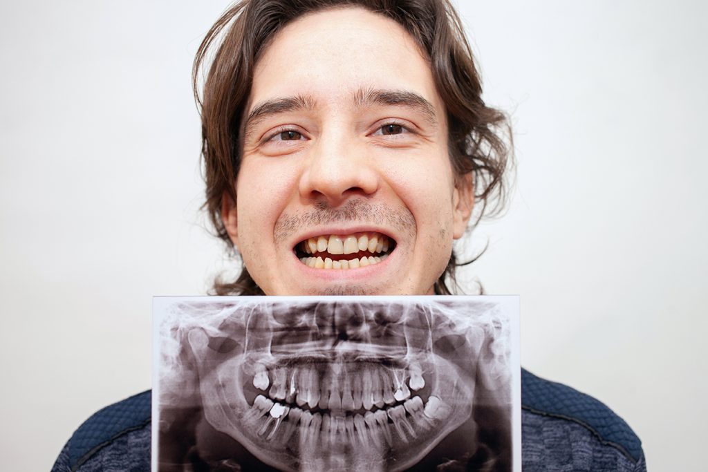 planificación de implantes dentales
