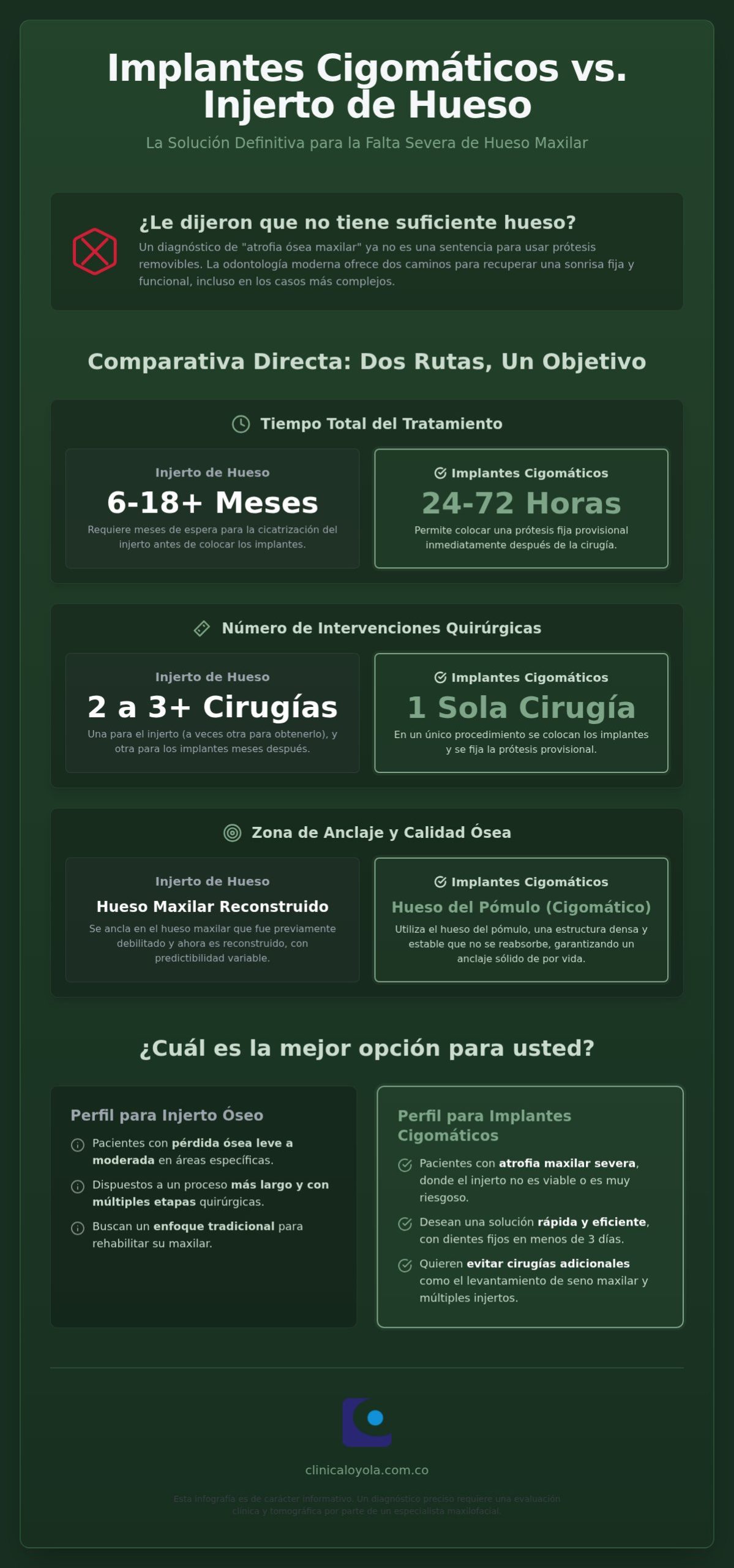 Implantes cigomáticos vs. injerto de hueso: ¿Cuál es la mejor opción para usted?
