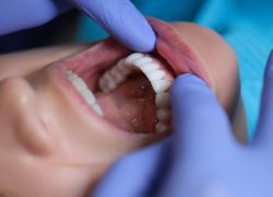 Rehabilitación-oral